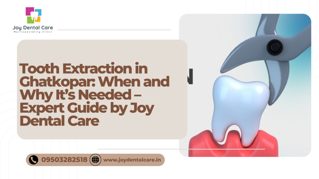 Tooth Extraction in Ghatkopar: When and Why It’s Needed – Expert Guide by Joy Dental Care